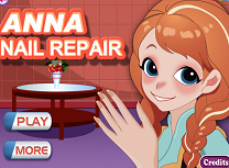 Anna Repara Unghiile