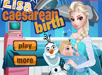 Elsa Nastere Prin Cezariana