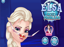 Elsa Probleme la Nas