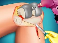 Operatie la genunchi